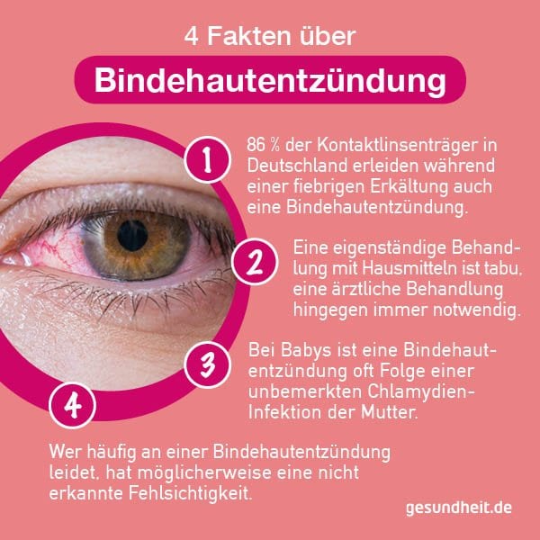 4 Fakten über Bindehautentzündungen (Infografik)