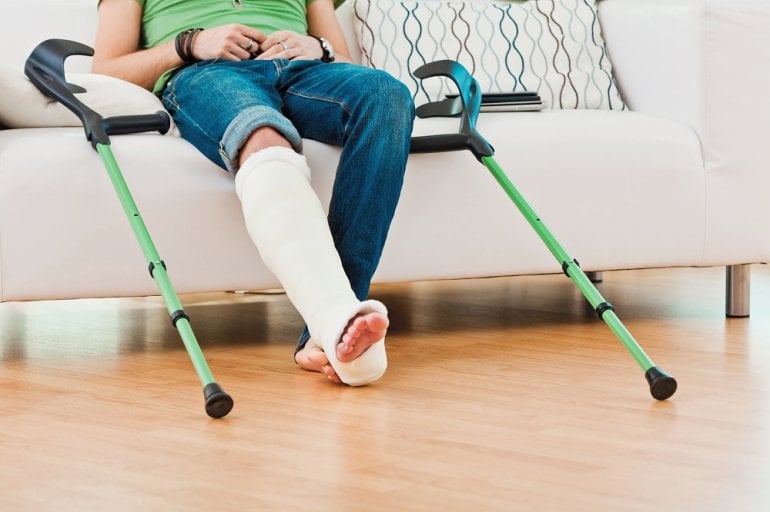 Mann mit Ermüdungsbruch trägt Gips am Bein