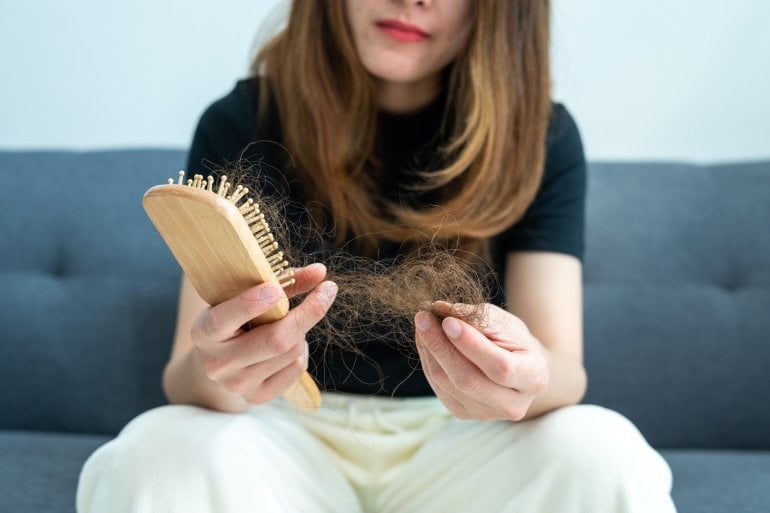 Frau mit Haarausfall hält eine Bürste in den Händen