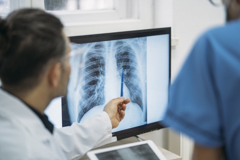 Arzt zeigt Röntgenbild einer Lunge mit Sarkoidose