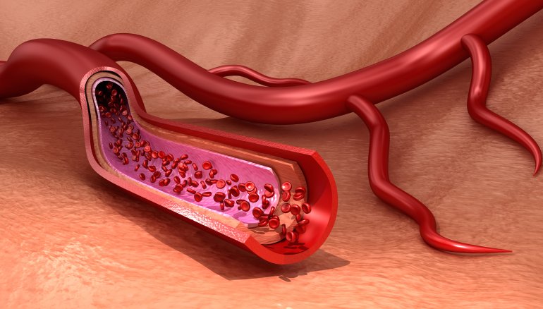 Thrombozytopenie: Thrombozyten (Illustration)