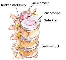 Bandscheiben (anatomische Illustration)